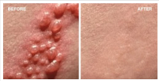 Beyond Simplex-Benefits